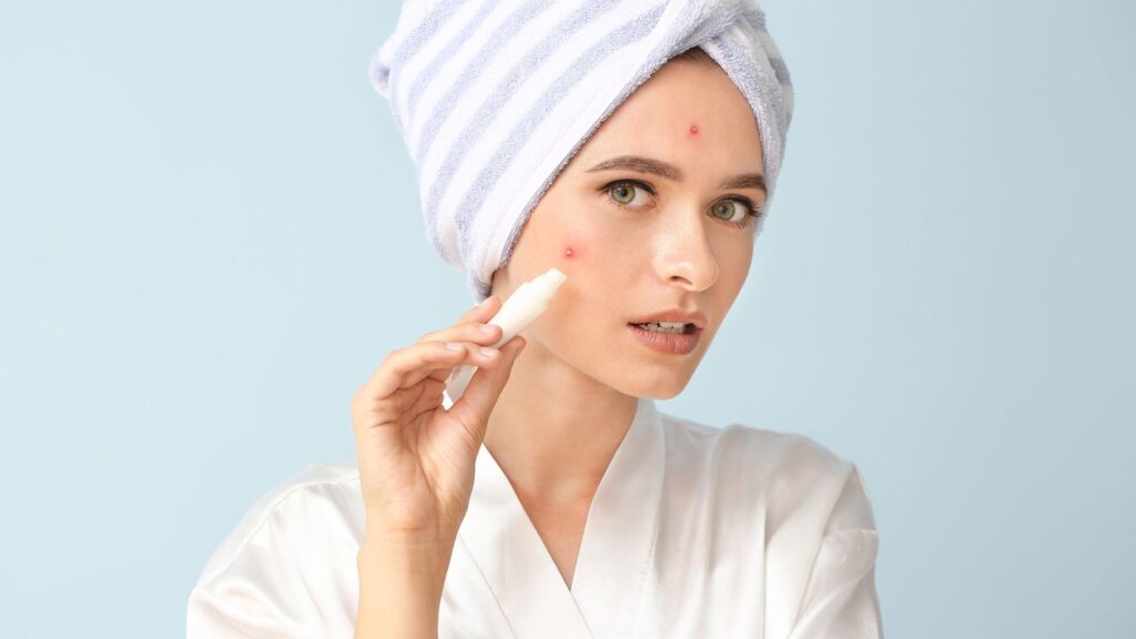 aloe vera can treat acne